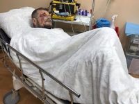Покушение на члена “Радикальной партии” Мосийчука: есть погибший и раненые