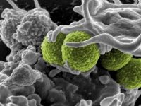 Специалисты нашли новый способ уничтожения супербактерий