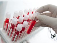 Ученые разработали технологию массового производства крови
